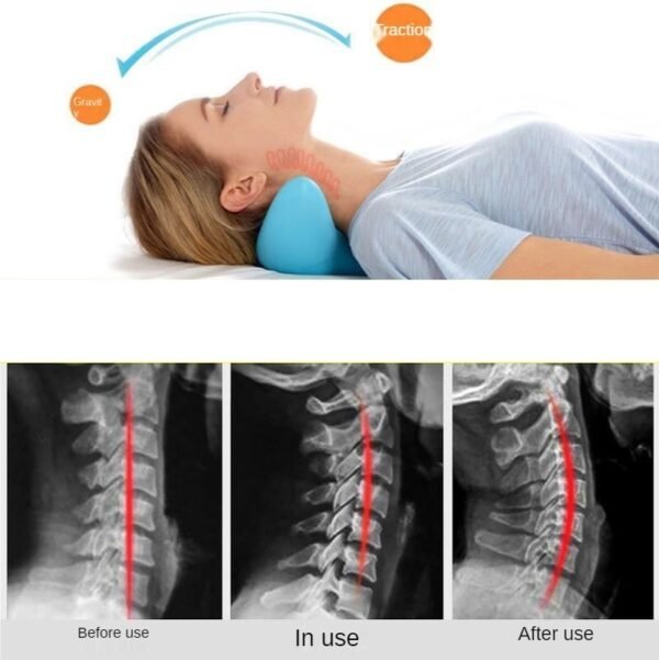 Cervical Spine Massage Pillow - Image 2